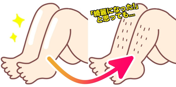 硬毛