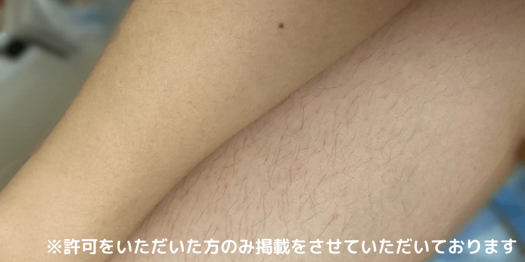 腕（上）／脚（下）