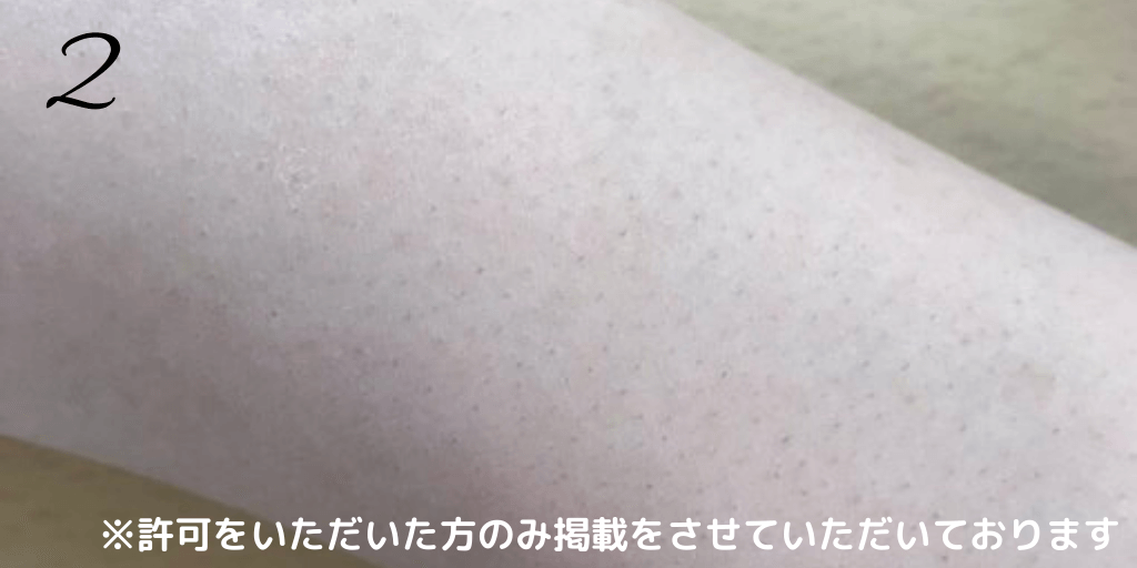 腕（うで）