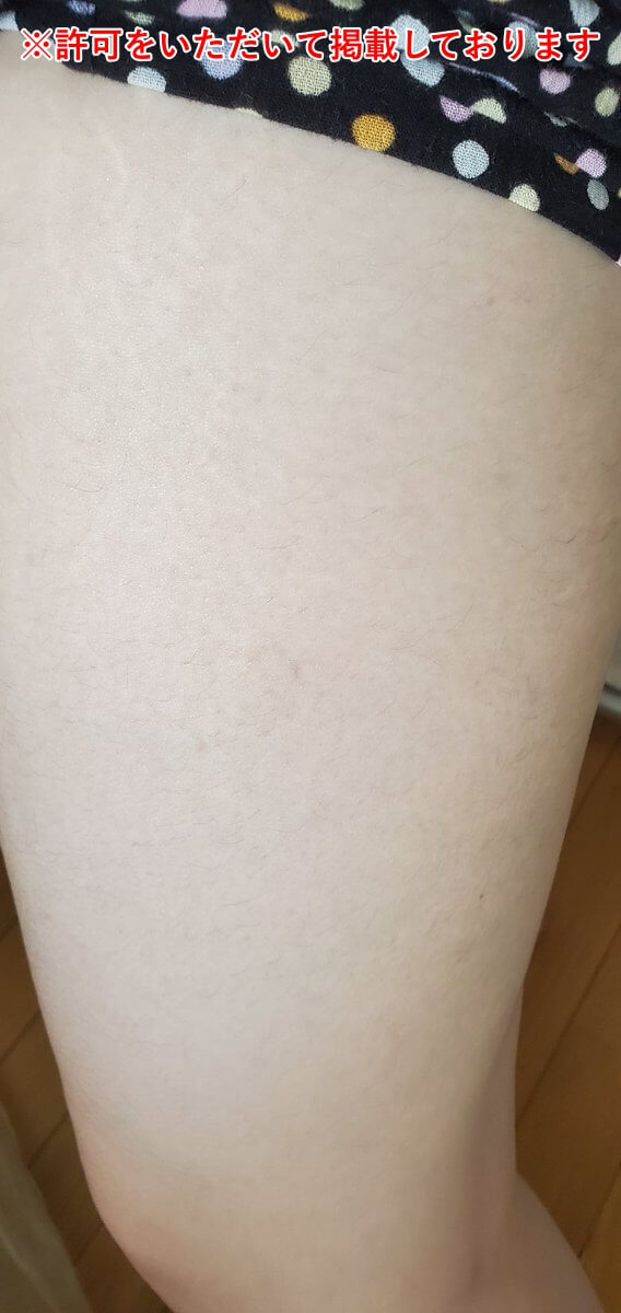 太もも