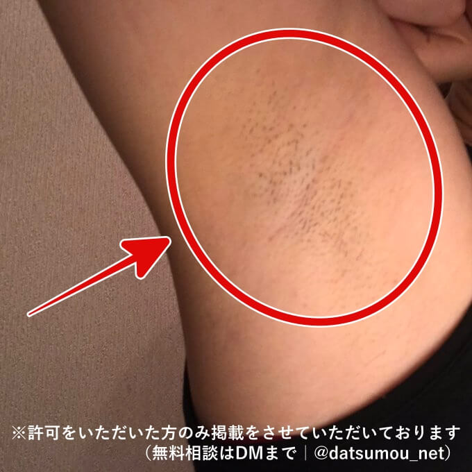 脇（わき）