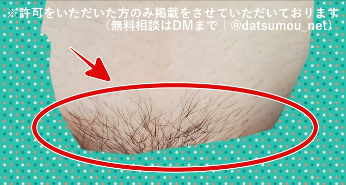 Vライン（上部）